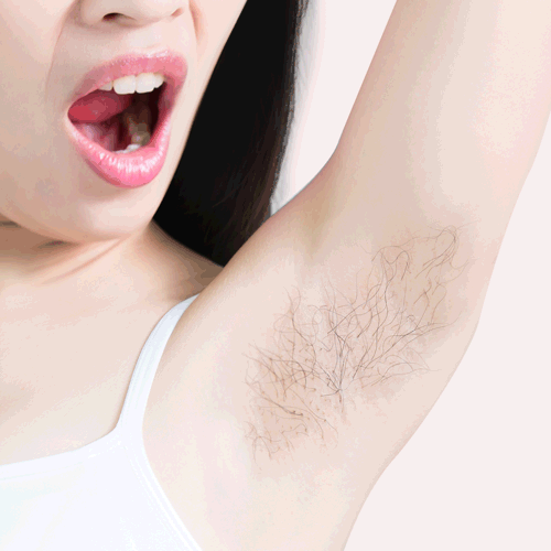 Sydonic Permanent Hair Removal Cream For Men and Women