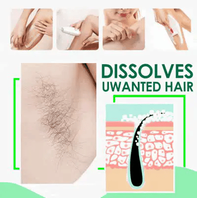 Sydonic Permanent Hair Removal Cream For Men and Women