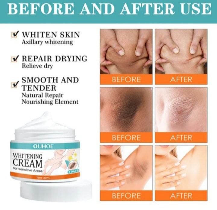Sensitive Area Whitening Cream For Private Parts, Underarms, Inner Thighs, And Dark Spot Lightening(30ml)