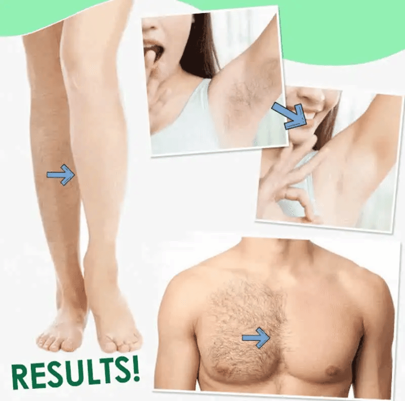 Sydonic Permanent Hair Removal Cream For Men and Women