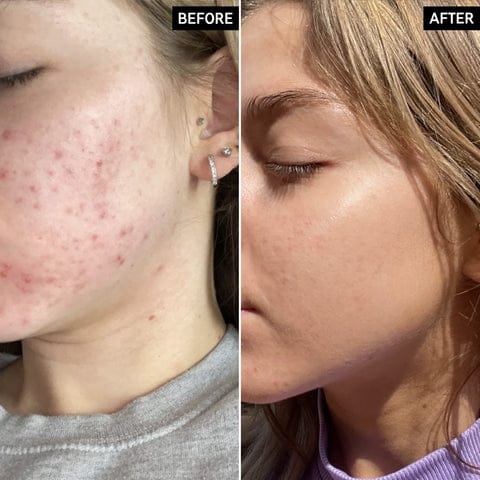 The Ordinary Niacinamide Serum 10% + Zinc 1% Supersize Serum 30ml | Best Quality Serum 30ml